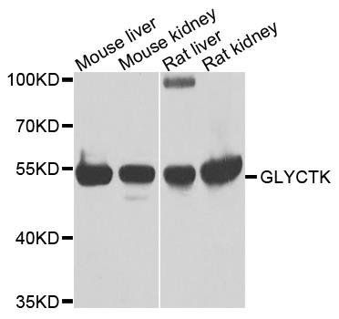 GLYCTK antibody