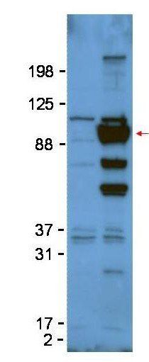 Glypican-1 antibody
