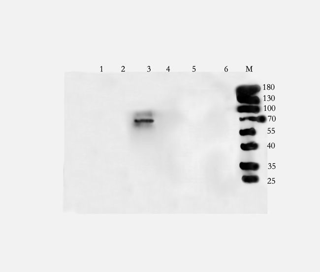 Glypican-1 Rabbit Polyclonal Antibody