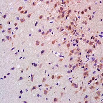 Glypican 1 Rabbit Polyclonal Antibody