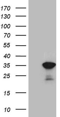 GM CSF (CSF2) antibody