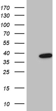 GM CSF (CSF2) antibody