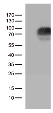 GM CSF Receptor alpha (CSF2RA) antibody