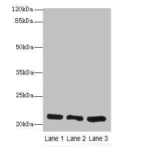 GM2A antibody