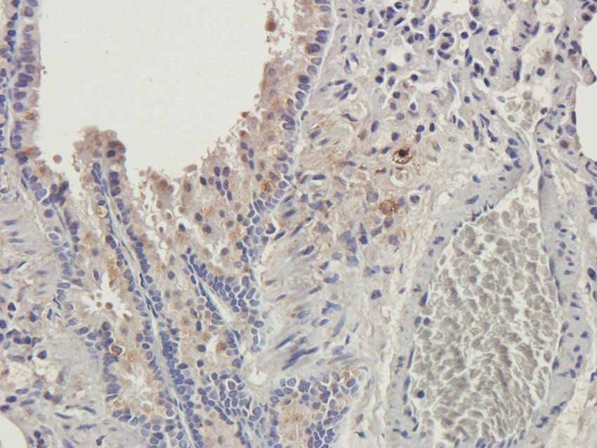 GMCSF antibody