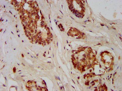 GMDS Antibody