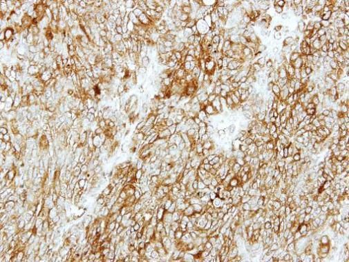 GMDS antibody [N2C3]