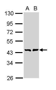 GMDS Rabbit Polyclonal Antibody