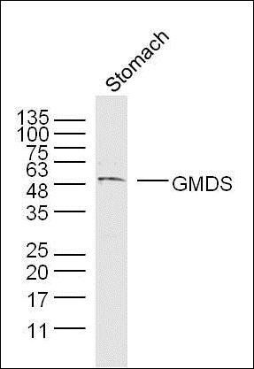 GMDS Rabbit Polyclonal Antibody