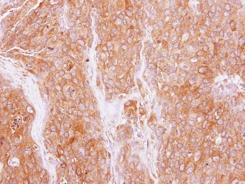 GMF beta antibody [N1C3]