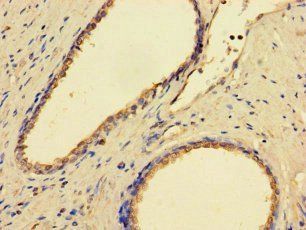 GMPPB Antibody