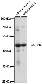 GMPPB antibody