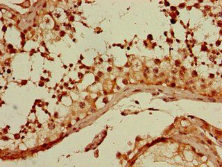 GNA11 antibody