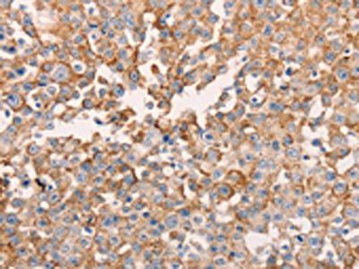 GNA11 Antibody