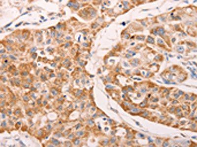 GNA11 Antibody