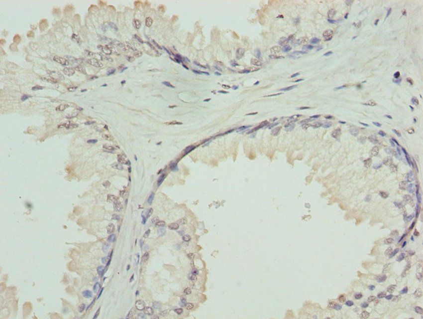GNA14 Antibody