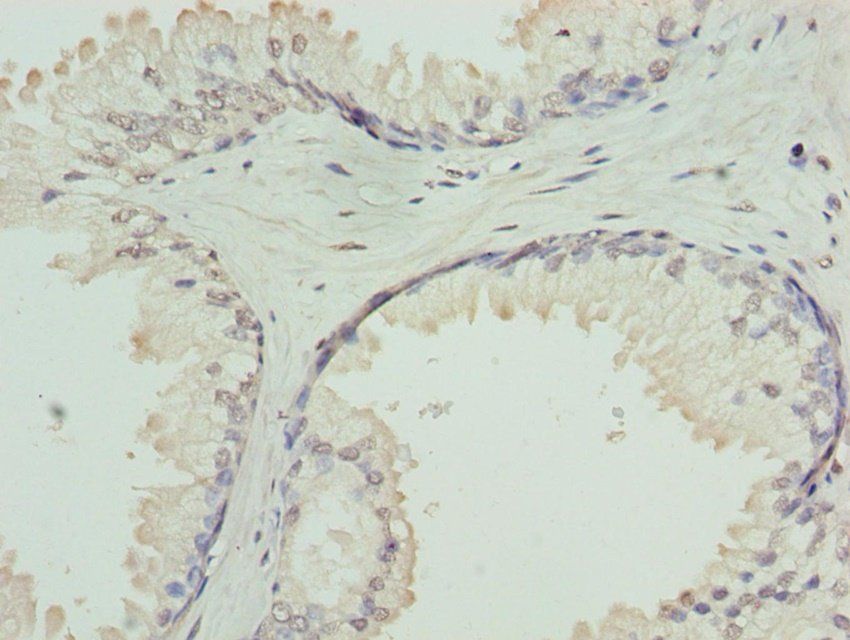 GNA14 antibody