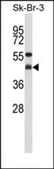 GNAI2 antibody