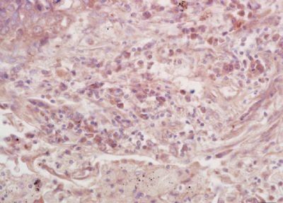 GNAO1 Rabbit Polyclonal Antibody