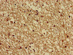 GNAS Antibody