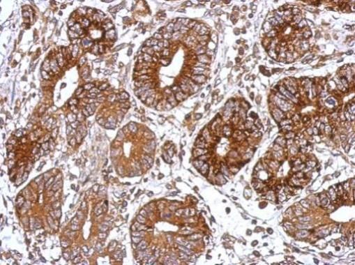 GNAS antibody [C2C3-2], C-term
