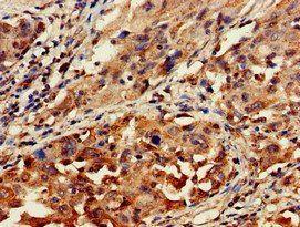 GNAT1 Antibody