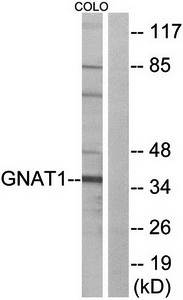 GNAT1 antibody