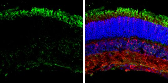 GNAT2 antibody [N3C3]