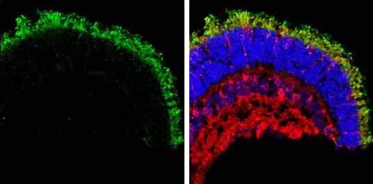 GNAT2 Rabbit Polyclonal Antibody