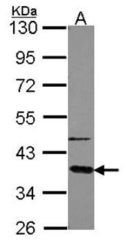 GNAT2 antibody