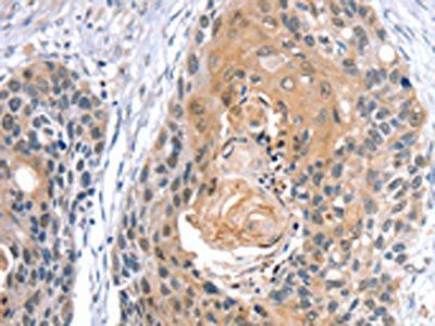 GNAT3 Antibody