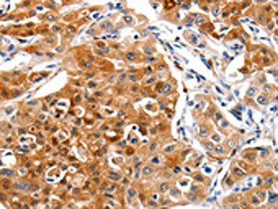 GNAZ Antibody