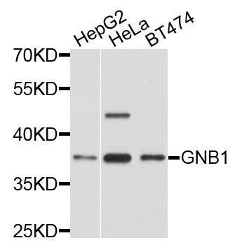 GNB1 antibody