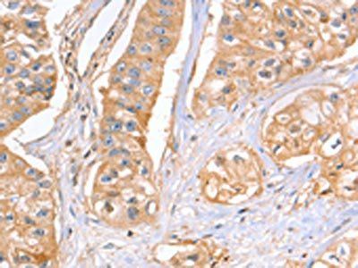 GNB1 Antibody