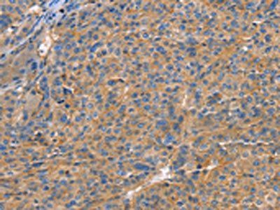 GNB1 Antibody