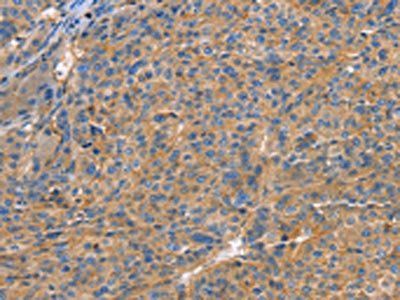 GNB1 antibody