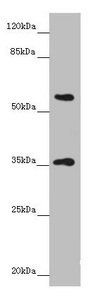 GNB1L antibody