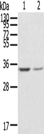 GNB2L1 antibody
