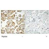 GNE Antibody