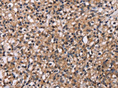 GNL3 Antibody