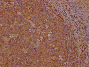 GNLY Antibody