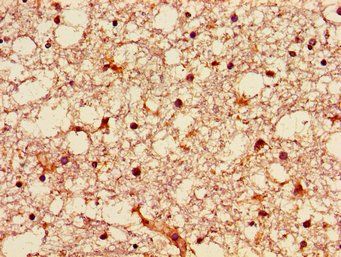 GNPAT Antibody