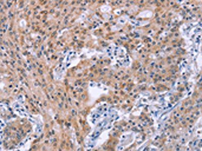 GNPAT Antibody