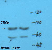 GNPAT Rabbit Polyclonal Antibody