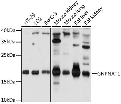 GNPNAT1 antibody