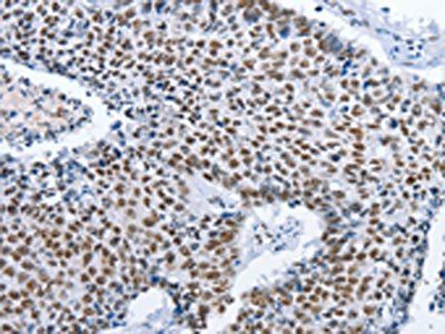 GNRH1 Antibody