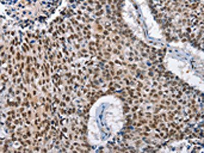 GNRH1 antibody