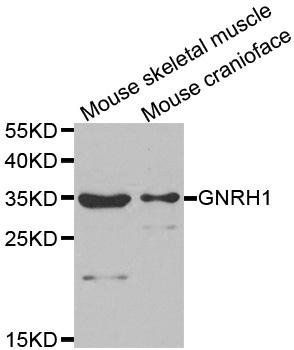 GNRH1 antibody