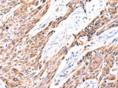 GNRHR Antibody