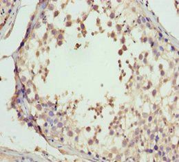 GNS antibody